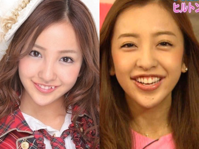 板野友美 歯並びの比較画像