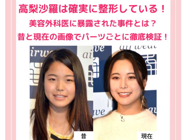 高梨沙羅の整形費用は0万円 目や鼻などの変化を昔から現在の画像で徹底検証 トレンドワンダーランド